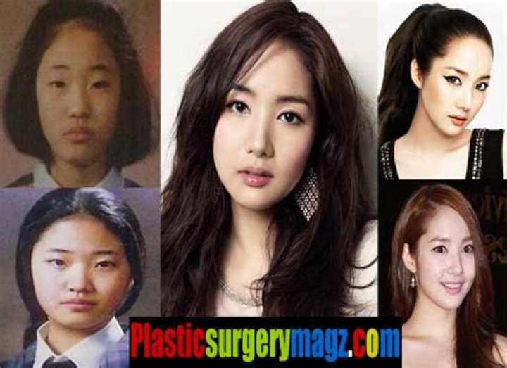 Park Min Young plastic surgery Nose Job, Double eyelid surgery, Facelift